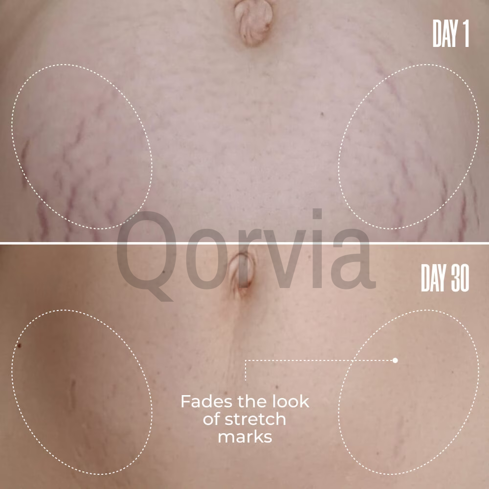 Qorvia Belly Firming