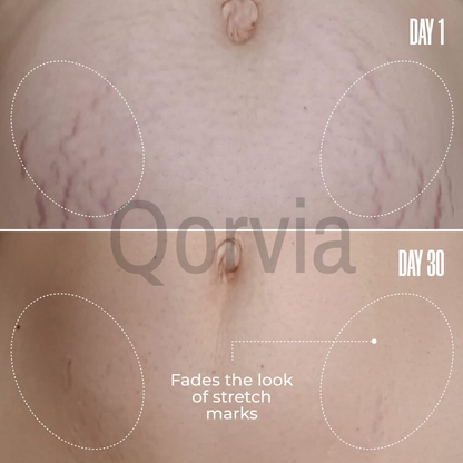 Qorvia Belly Firming